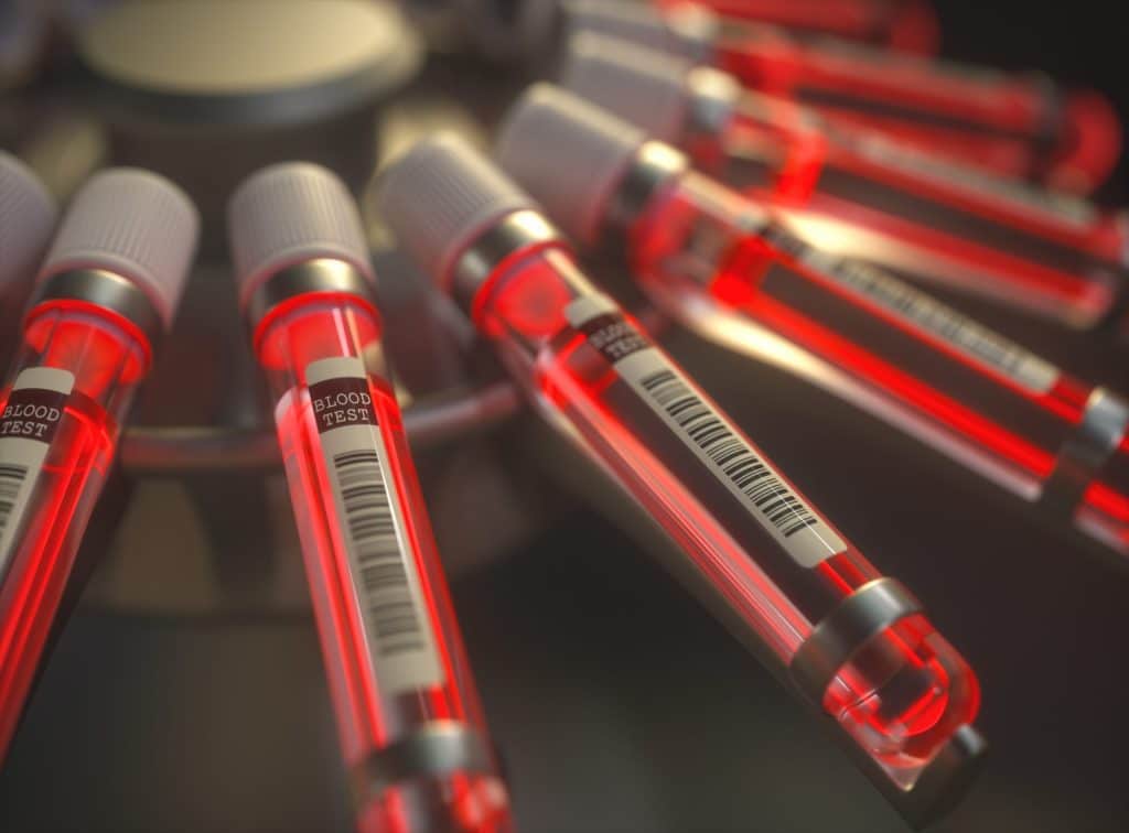 Proquimed Laboratorio Clínico-Sucursales|3D illustration. Centrifuge blood machine. Chemical test, bright red liquid inside the test tubes.&_