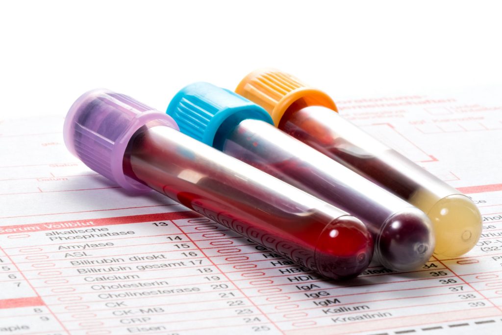 Proquimed Laboratorio Clínico-Inicio|Blutproben liegen auf einem Laborformular zur Festellung der Blutwerte&_