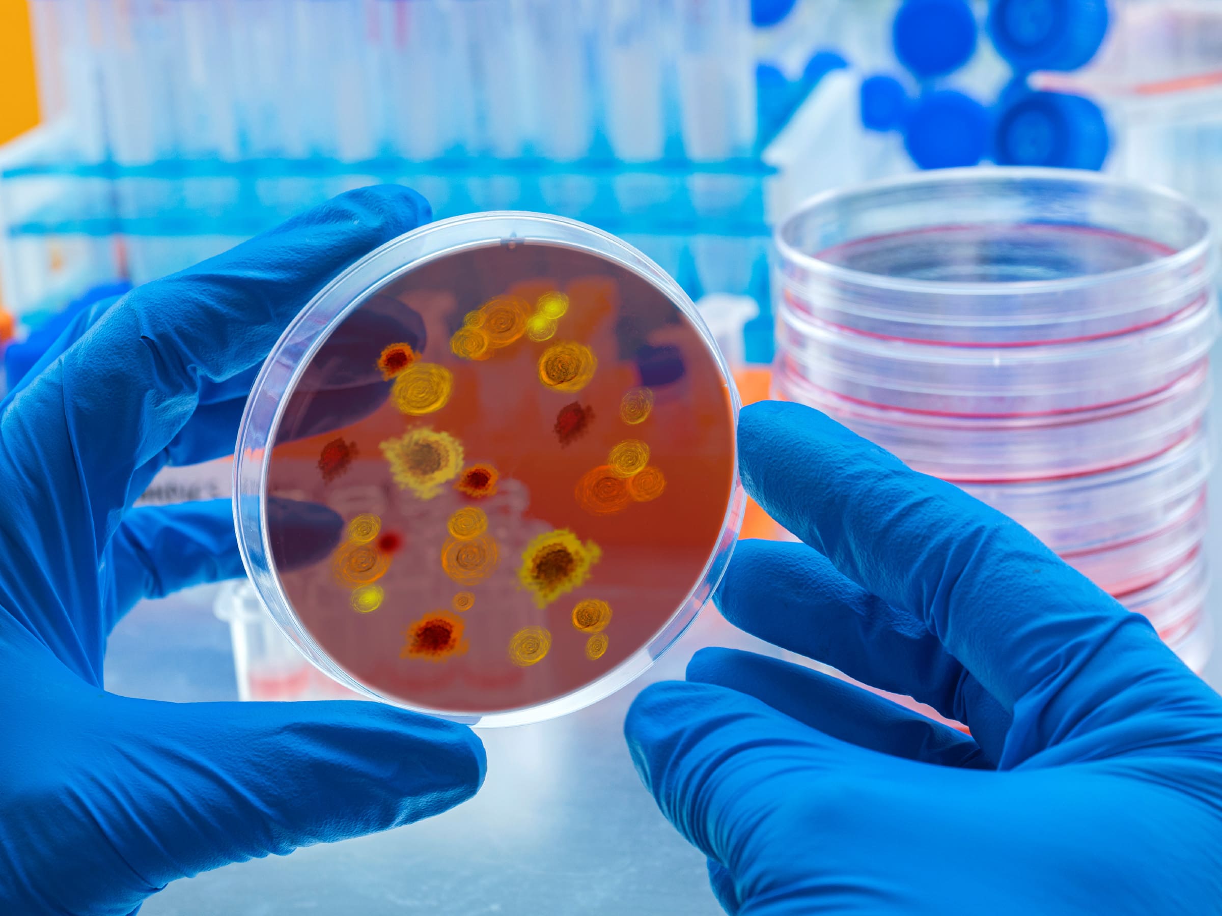 Lo que debes Saber acerca del dengue