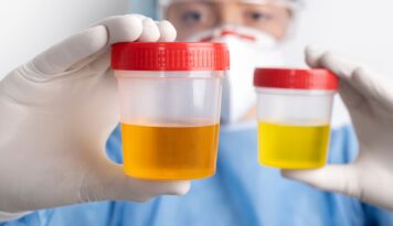 Programas de detección de drogas en el trabajo